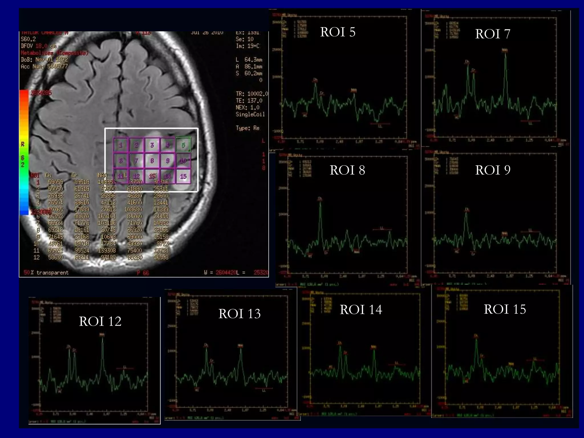ROI 5

ROI 8

ROI 12

ROI 13

ROI 14

ROI 7

ROI 9

ROI 15

 