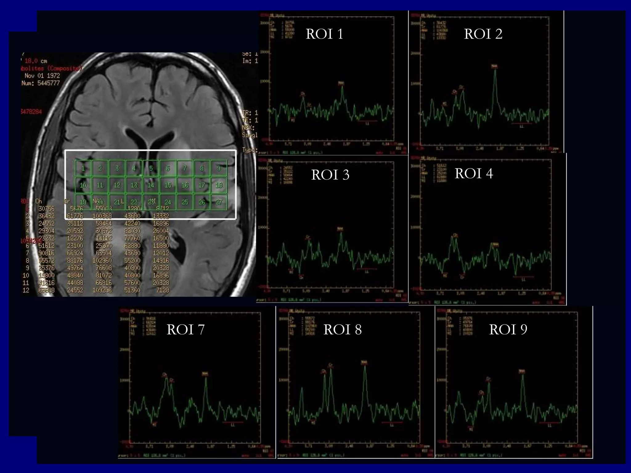 ROI 1

ROI 3

ROI 7

ROI 8

ROI 2

ROI 4

ROI 9

 