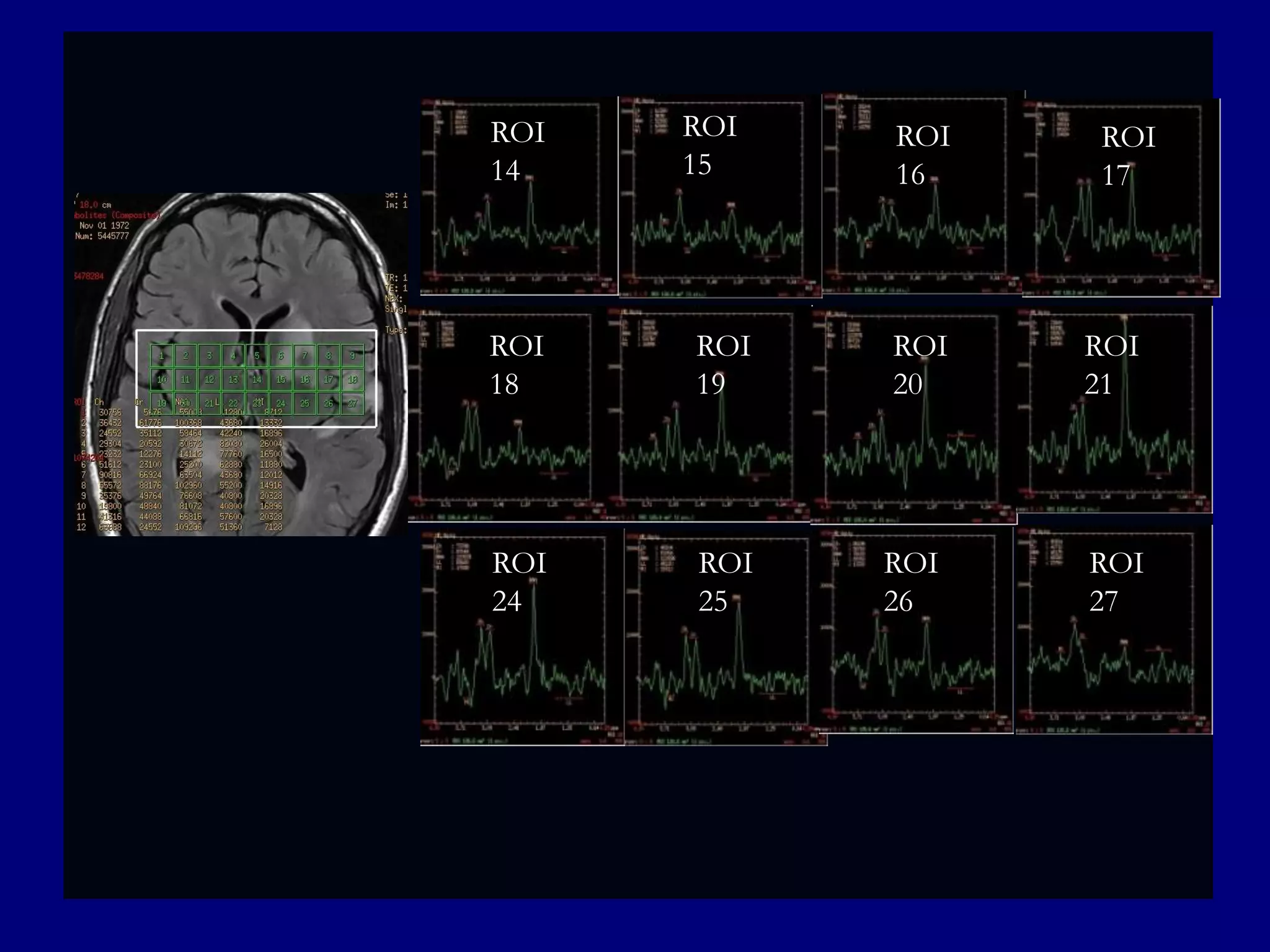 ROI
14

ROI
15

ROI
16

ROI
17

ROI
18

ROI
19

ROI
20

ROI
21

ROI
24

ROI
25

ROI
26

ROI
27

 