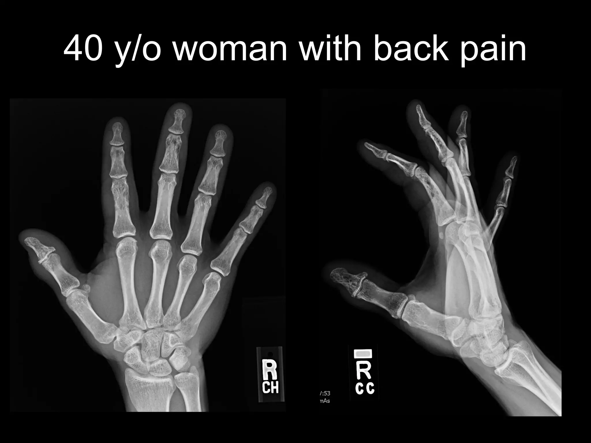 40 y/o woman with back pain  
