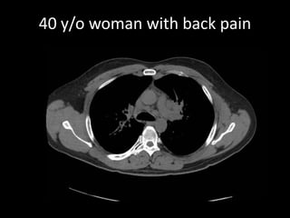 40 y/o woman with back pain 
 