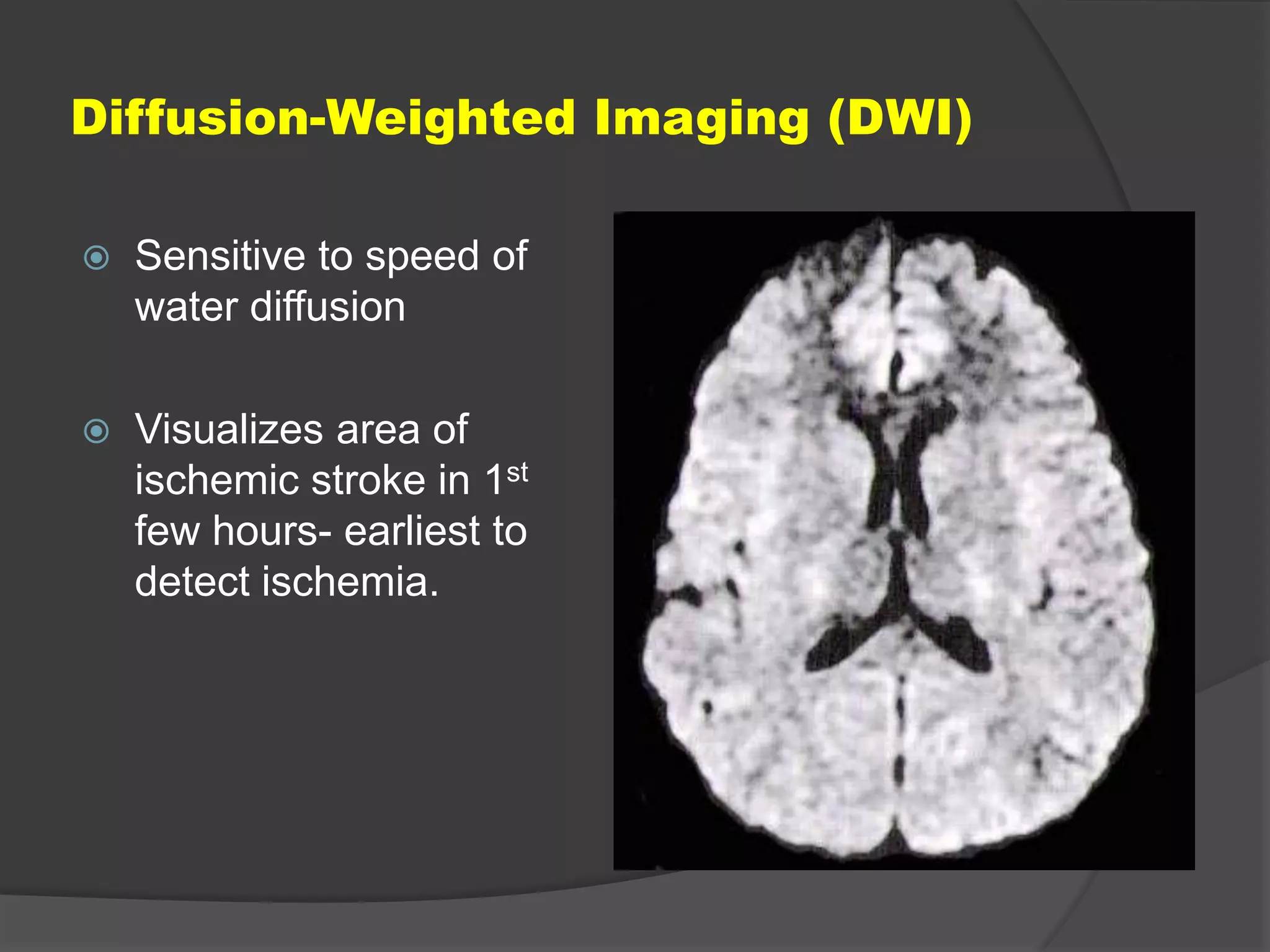 Diffusion-Weighted Imaging (DWI)


Sensitive to speed of
water diffusion



Visualizes area of
ischemic stroke in 1st
few hours- earliest to
detect ischemia.

 