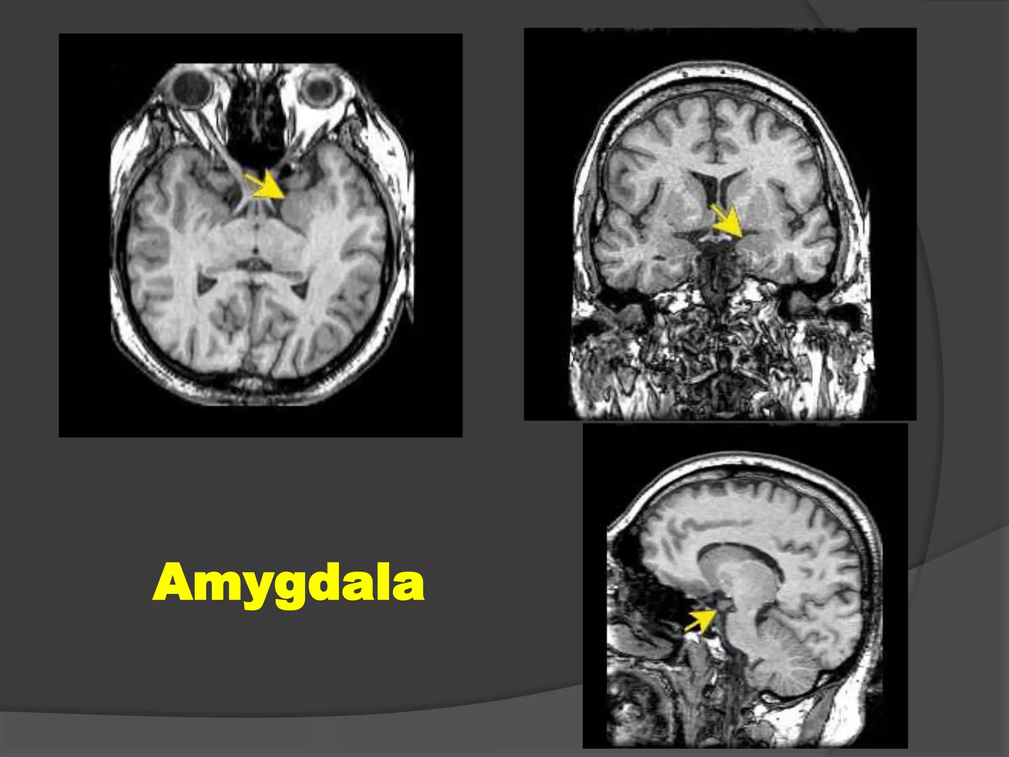 Amygdala

 