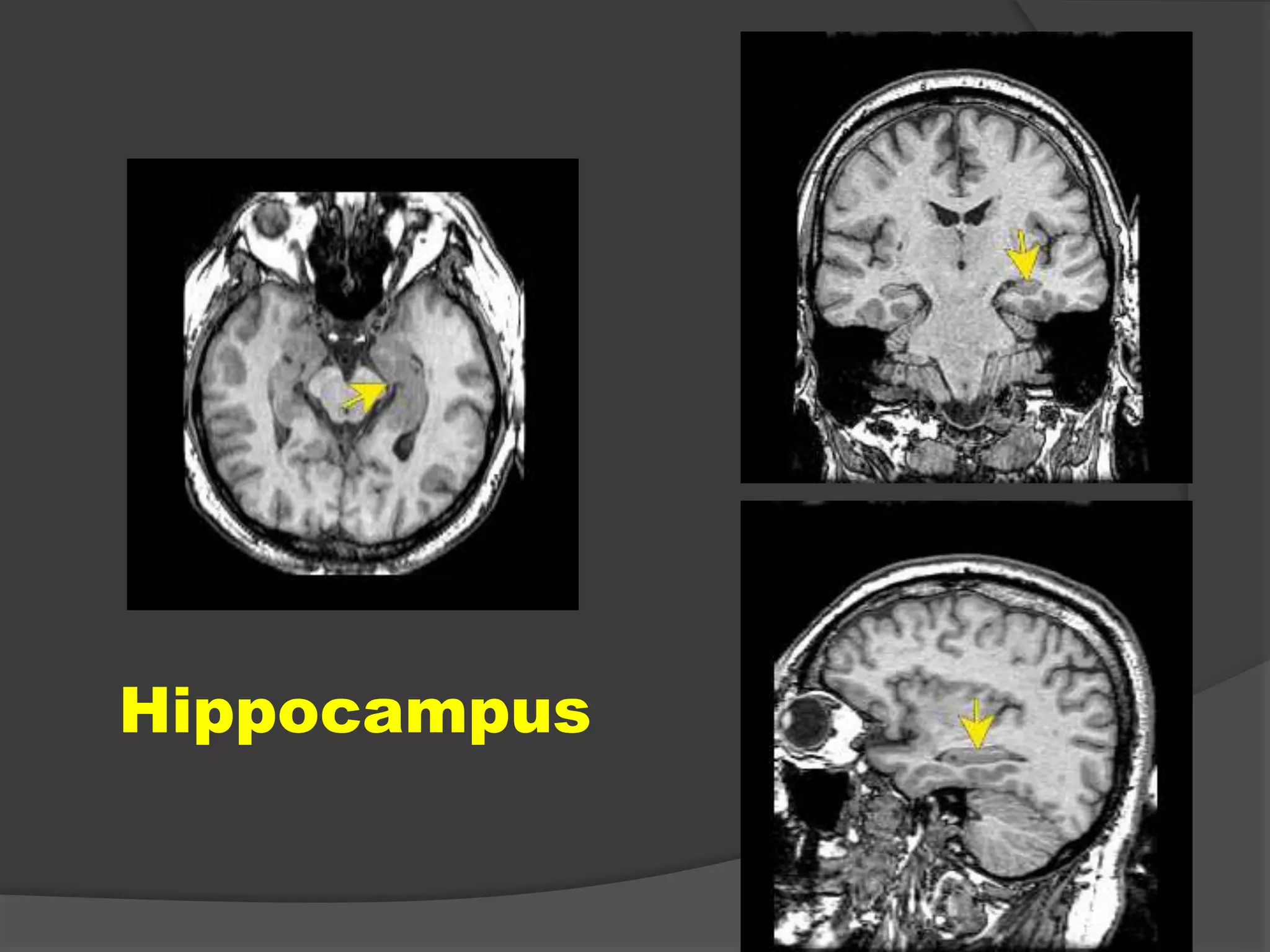 Hippocampus

 