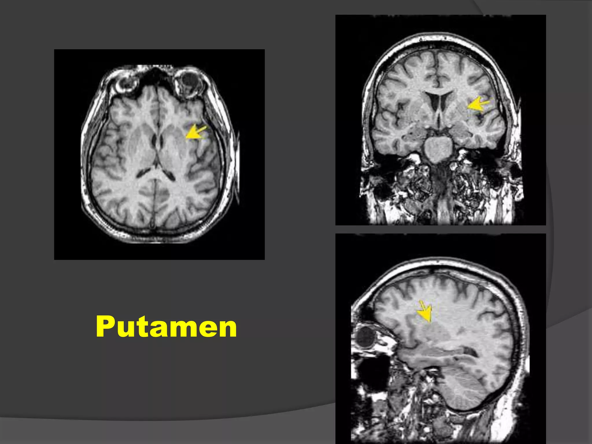 Putamen

 