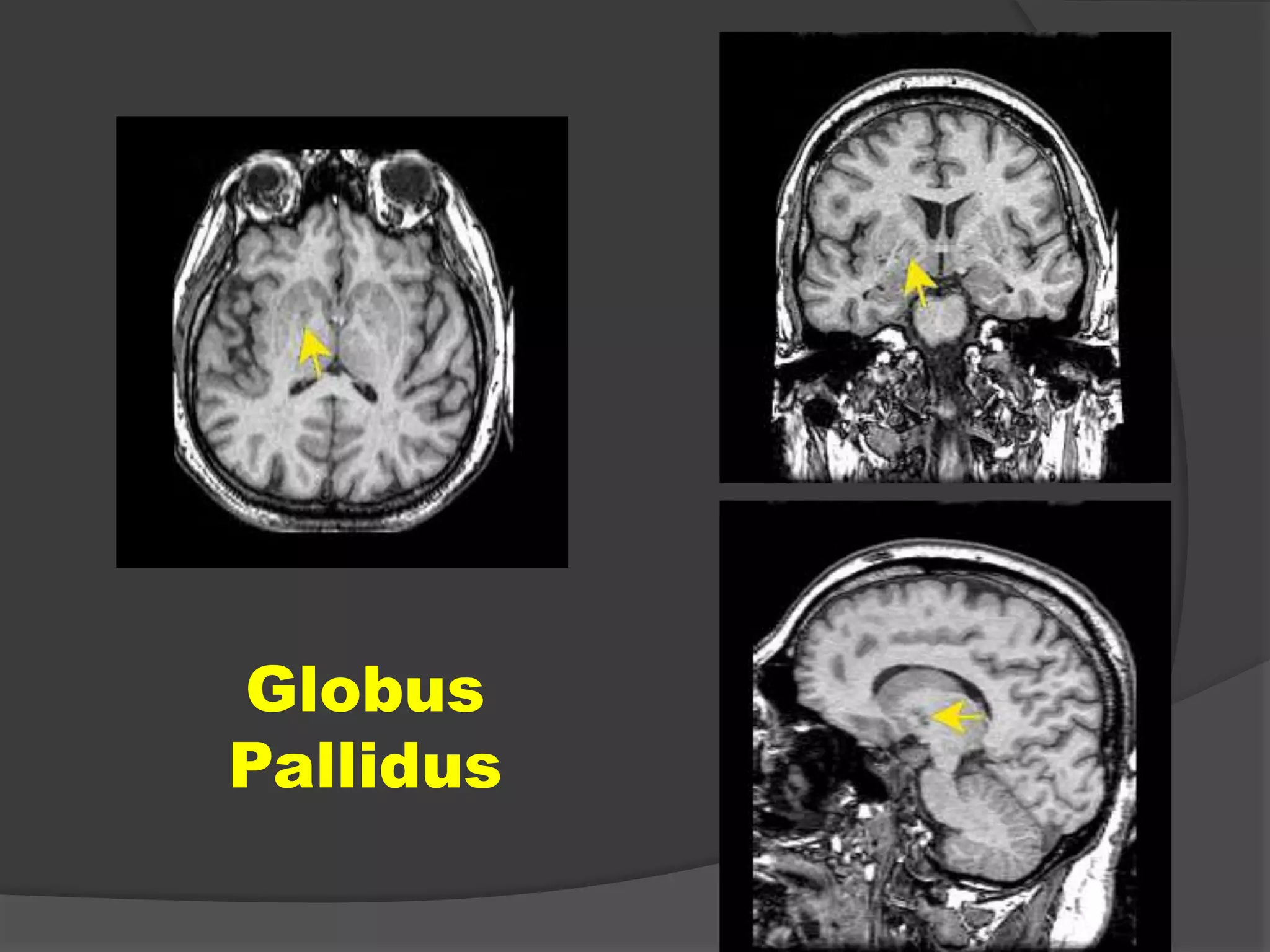 Globus
Pallidus

 