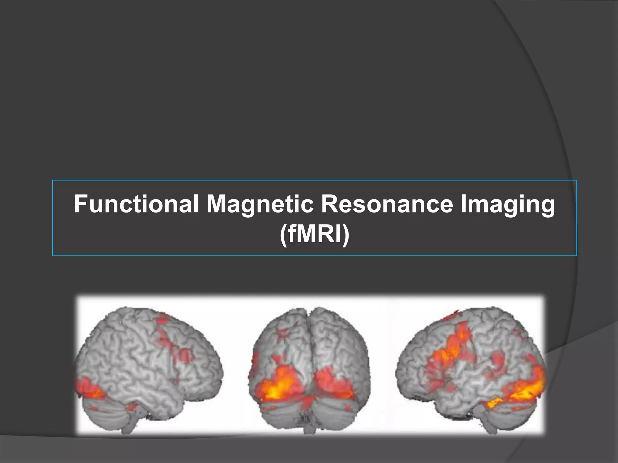 Functional Magnetic Resonance Imaging
(fMRI)

 