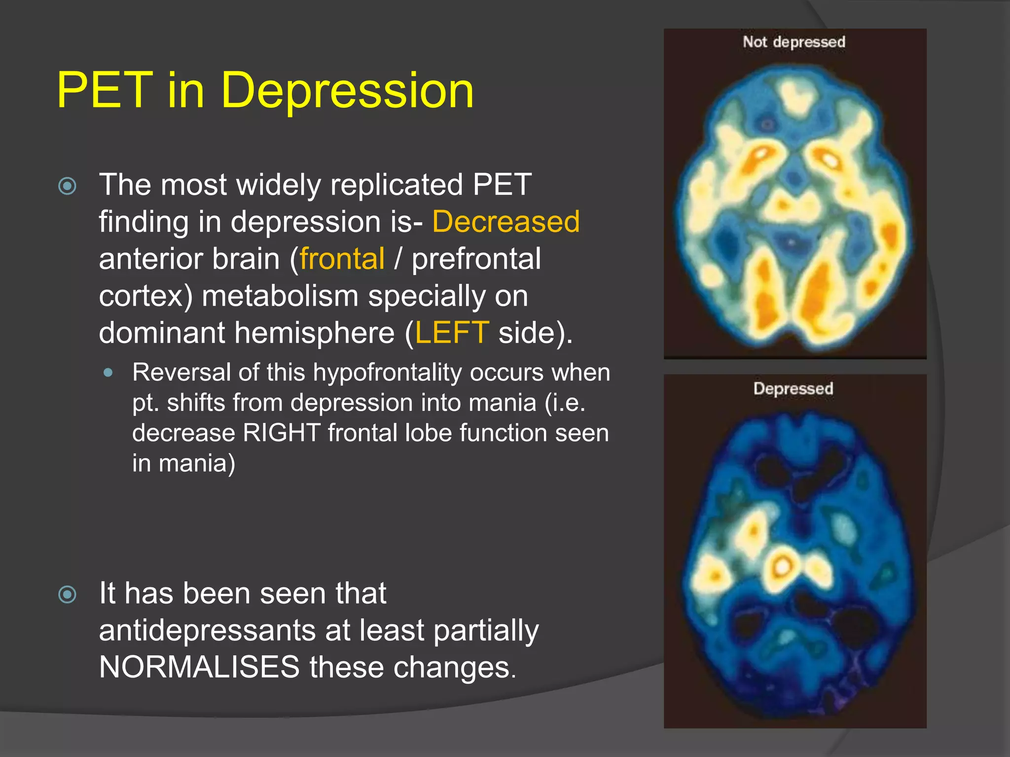 PET in Depression


The most widely replicated PET
finding in depression is- Decreased
anterior brain (frontal / prefrontal
cortex) metabolism specially on
dominant hemisphere (LEFT side).
 Reversal of this hypofrontality occurs when

pt. shifts from depression into mania (i.e.
decrease RIGHT frontal lobe function seen
in mania)



It has been seen that
antidepressants at least partially
NORMALISES these changes.

 