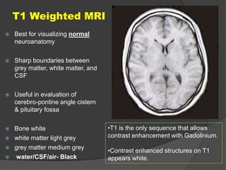 T1 Weighted MRI


Best for visualizing normal
neuroanatomy



Sharp boundaries between
grey matter, white matter, and
CSF



Useful in evaluation of
cerebro-pontine angle cistern
& pituitary fossa



Bone white
white matter light grey
grey matter medium grey
water/CSF/air- Black






•T1 is the only sequence that allows
contrast enhancement with Gadolinium.
•Contrast enhanced structures on T1
appears white.

 