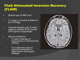 Fluid Attenuated Inversion Recovery
(FLAIR)


Special type of MRI scan



T1 image is inverted & added to
the T2 image



Contrast between grey & white
matter is doubled & the normal
CSF signal is suppressed.



Special indications
1.

To detect Sclerosis of
hippocampus in Temporal lobe
epilepsy.

2.

To Localize the areas of
abnormal metabolism in
degenerative neurological
diseases.

 