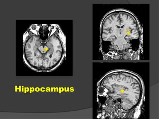 Hippocampus

 