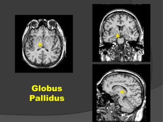 Globus
Pallidus

 