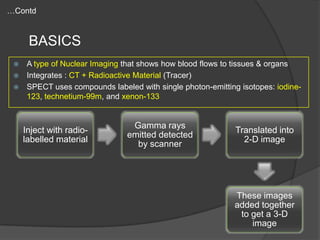 …Contd

BASICS
A type of Nuclear Imaging that shows how blood flows to tissues & organs
 Integrates : CT + Radioactive Material (Tracer)
 SPECT uses compounds labeled with single photon-emitting isotopes: iodine123, technetium-99m, and xenon-133


Inject with radiolabelled material

Gamma rays
emitted detected
by scanner

Translated into
2-D image

These images
added together
to get a 3-D
image

 