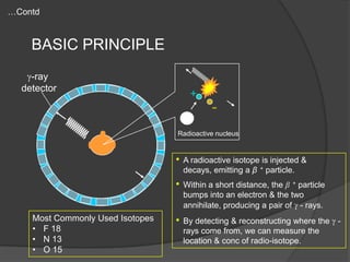 …Contd

BASIC PRINCIPLE
-ray
detector

+

Radioactive nucleus

•
•
Most Commonly Used Isotopes
• F 18
• N 13
• O 15

A radioactive isotope is injected &
decays, emitting a β + particle.
Within a short distance, the β + particle
bumps into an electron & the two
annihilate, producing a pair of - rays.

•

By detecting & reconstructing where the rays come from, we can measure the
location & conc of radio-isotope.

 