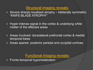 Structural imaging reveals

Severe sharply localised atrophy – bilaterally symmetric
―KNIFE-BLADE ATROPHY‖



Hyper-intense signal in the cortex & underlying white
matter of the affected areas



Areas involved- dorsolateral prefrontal cortex & medial
temporal lobes
Areas spared- posterior parietal and occipital cortices.



Functional imaging reveals

Fronto-temporal hypometabolism

 