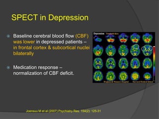 SPECT in Depression


Baseline cerebral blood flow (CBF)
was lower in depressed patients –
in frontal cortex & subcortical nuclei
bilaterally



Medication response –
normalization of CBF deficit.

Joensuu M et al (2007) Psychiatry Res. 154(2): 125-31

 