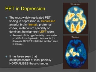 PET in Depression


The most widely replicated PET
finding in depression is- Decreased
anterior brain (frontal / prefrontal
cortex) metabolism specially on
dominant hemisphere (LEFT side).
 Reversal of this hypofrontality occurs when

pt. shifts from depression into mania (i.e.
decrease RIGHT frontal lobe function seen
in mania)



It has been seen that
antidepressants at least partially
NORMALISES these changes.

 