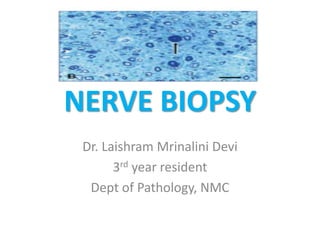 NERVE BIOPSY
Dr. Laishram Mrinalini Devi
3rd year resident
Dept of Pathology, NMC
 