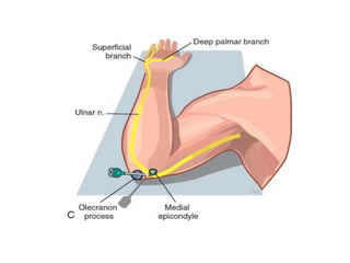 Nerve block | PPTX