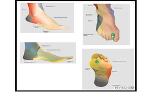 Peripheral Nerve block(ankle block,wrist block, digital block) | PPTX
