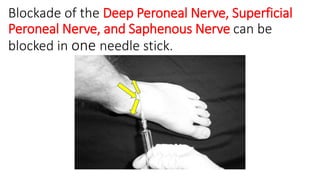 Peripheral Nerve block(ankle block,wrist block, digital block) | PPTX