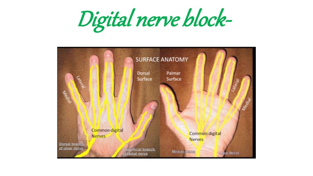 Peripheral Nerve block(ankle block,wrist block, digital block)
