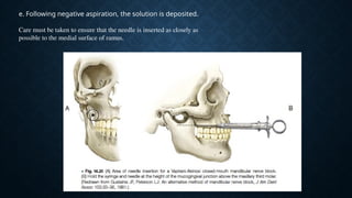 Comprehensive Guide to Mandibular and Maxillary Nerve Block Techniques ...