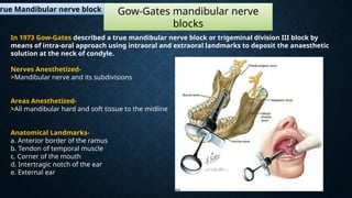 Comprehensive Guide to Mandibular and Maxillary Nerve Block Techniques ...