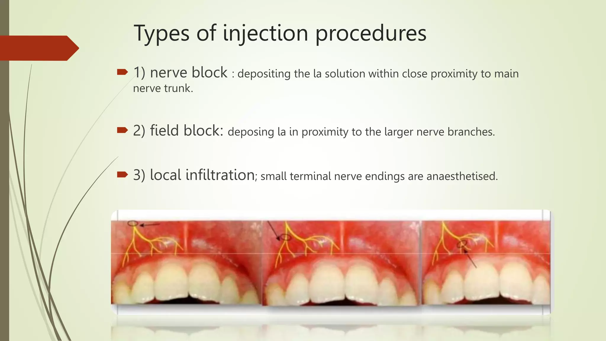 NERVE BLOCKS AND ANATOMICAL LANDMARKS IN PEDIATRIC DENTISTRY.pptx