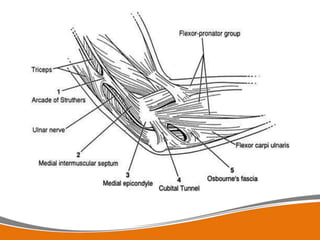 Compressive Neuropathy Chest Nerve Compression for neuropaths 12.pptx