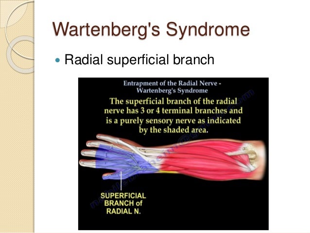 Peripheral Nerve Compression Syndrome Peripheral Nerve Compression Syndrome