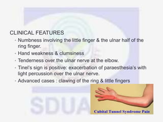 CLINICAL FEATURES
• Numbness involving the little finger & the ulnar half of the
ring finger.
• Hand weakness & clumsiness
• Tenderness over the ulnar nerve at the elbow.
• Tinel’s sign is positive: exacerbation of paraesthesia’s with
light percussion over the ulnar nerve.
• Advanced cases : clawing of the ring & little fingers
 