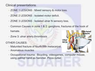 Clinical presentations:
• ZONE 1 LESIONS : Mixed sensory & motor loss.
• ZONE 2 LESIONS : Isolated motor deficit.
• ZONE 3 LESIONS : Isolated ulnar N sensory loss.
• Common Causes in zone 1 & 2: ganglions, fractures of the hook of
hamate.
• Zone 3: ulnar artery thrombosis
OTHER CAUSES:
• Malunited fracture of fourth/fifth metacarpal.
• Anomalous muscles
• Occupational trauma : Bicycling, videogames, computer mouse,
using palmof hand as hammer. Pizza cutter.
 