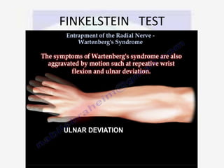 FINKELSTEIN TEST
 