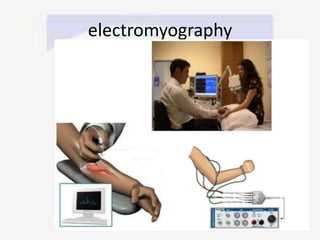 electromyography
 