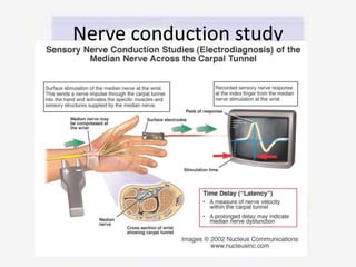 Nerve conduction study
 