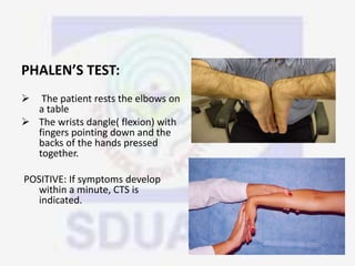 PHALEN’S TEST:
 The patient rests the elbows on
a table
 The wrists dangle( flexion) with
fingers pointing down and the
backs of the hands pressed
together.
POSITIVE: If symptoms develop
within a minute, CTS is
indicated.
 
