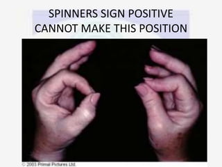 SPINNERS SIGN POSITIVE
CANNOT MAKE THIS POSITION
 