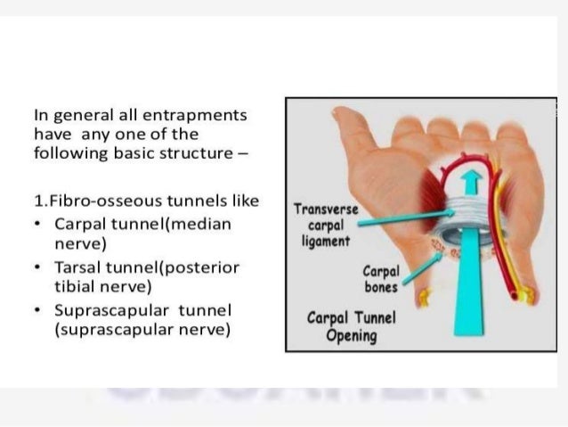 Compression Syndrom Nerve Compression Syndrome – Nervenkompression Symptome – GLJY