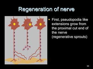 Regeneration of nerve
 First, pseudopodia like
extensions grow from
the proximal cut end of
the nerve
(regenerative sprouts)
55
 