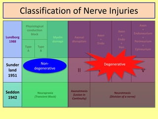 Classification of Nerve Injuries
Lundborg
1988
Physiological
conduction
block
Myelin
damage
Axonal
disruption
Axon
+
Endo
Axon
+
Endo
+
Peri
Axon
+
Endoneurium
+
Perineurium
+
Epineurium
Type
A
Type
B
Sunder
land
1951
I II III IV V
Seddon
1942
Neurapraxia
(Transient Block)
Axonotmesis
(Lesion in
Continuity)
Neurotmesis
(Division of a nerve)
Non-
degenerative
Degenerative
 