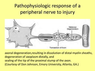 Pathophysiologic response of a
peripheral nerve to injury
axonal degeneration,resulting in dissolution of distal myelin sheaths,
degeneration of axoplasm distally, and
sealing of the tip of the proximal stump of the axon.
(Courtesy of Don Johnson, Emory University, Atlanta, GA.)
 