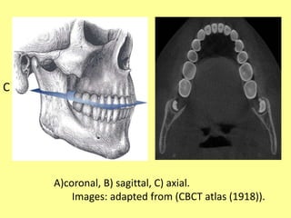 C
A)coronal, B) sagittal, C) axial.
Images: adapted from (CBCT atlas (1918)).
 