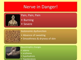 Nerve in Danger!
Pain, Pain, Pain
• Burning
• Severe
Autonomic dysfunction
• Absence of sweating
• Smoothness & dryness of skin
Neurotrophic changes
• edema
• erythema
• hypohydrosis
• Hypokeratosis
 