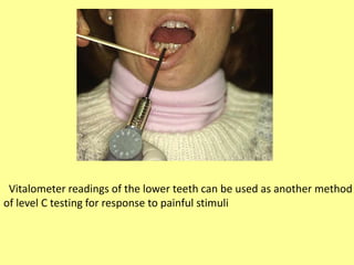 Vitalometer readings of the lower teeth can be used as another method
of level C testing for response to painful stimuli
 