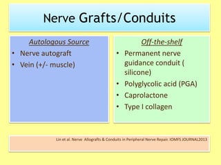 Nerve Grafts/Conduits
Autologous Source
• Nerve autograft
• Vein (+/- muscle)
Off-the-shelf
• Permanent nerve
guidance conduit (
silicone)
• Polyglycolic acid (PGA)
• Caprolactone
• Type I collagen
Lin et al. Nerve Allografts & Conduits in Peripheral Nerve Repair. IOMFS JOURNAL2013
 