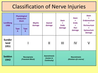 Classification of Nerve Injuries
Lundborg
1988
Physiological
conduction
block
Myelin
damage
Axonal
damage
Axon
+
Endo
damage
Axon
+
Endo
+
Peri
damage
Axon
+
Endoneurium
+
Perineurium
+
Epineurium
damage
Type
A
Type
B
Sunder
land
1951
I II III IV V
Seddon
1942
Neurapraxia
(Transient Block)
Axonotmesis
(Lesion in
Continuity)
Neurotmesis
(Division of a nerve)
 
