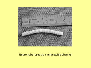 Neuro tube used as a nerve guide channel
 