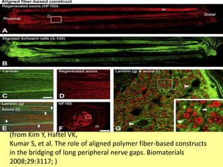 (from Kim Y, Haftel VK,
Kumar S, et al. The role of aligned polymer fiber-based constructs
in the bridging of long peripheral nerve gaps. Biomaterials
2008;29:3117; )
 