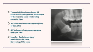 The availability of cone-beam CT
scans makes preoperative assessment
of the root and canal relationship
easier to view.
3% chance of temporary sensory loss
of lip & chin
0.5% chance of permanent sensory
loss lip & chin ︎
Look for: Radiolucent band
︎Deviation of the canal
︎Narrowing of the canal
 